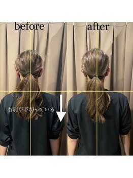 アイリー(Irie)/骨格矯正