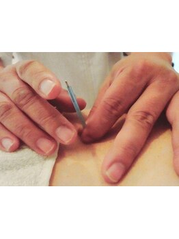 鍼灸施術を受けたい