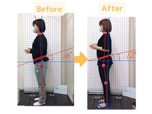 藤接骨院 藤枝警察署前院/骨盤矯正で腰痛、痩身達成♪