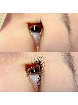 コア(Koa)/横顔も美しくしませんか?