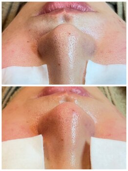 アトレ(Atre)/化粧のノリ大丈夫ですか？