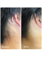 エース(ACE.)/うなじで差がつく！！