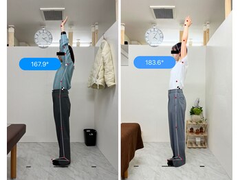 トワニ整体 新富町院(TOWANI整体)/腰痛/銀座/新富町/築地/整体