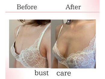 サロンツキ(salon tuki)/バストアップ/バストケア症例