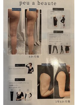 アノネ(Anone.)/疲労回復"着るながらエステ"