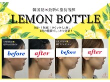 アモーラ(Amora)