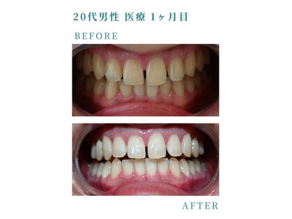 ミノリ(MINORI)の写真