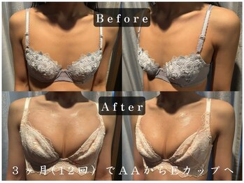 エステティックサロン パヒューム(Esthetic Salon Perfume)/何をしても効果がなかったのに…