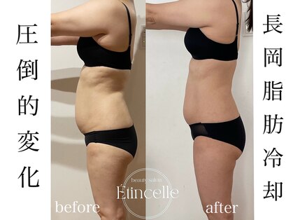 エタンセル(Etincelle)の写真