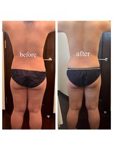 リラクゼーションサロンネロリ/結果重視の痩身メニュー