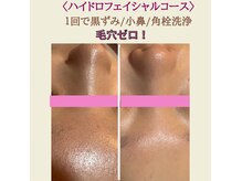 ポムポムボナー