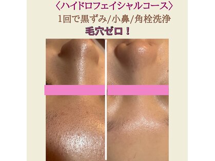 ポムポムボナーの写真