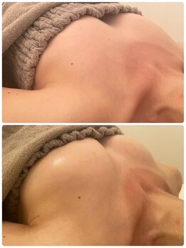 美人バスト 那覇店/バストアップ・育乳◆症例◆