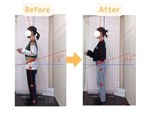 藤接骨院 藤枝警察署前院/腰痛・足のしびれ改善☆