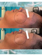 ポノ(Pono)/月一のメンテナンスDayに☆