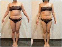 美容整体ウェリナ あま甚目寺院/小顔矯正/骨盤矯正/美脚サロン