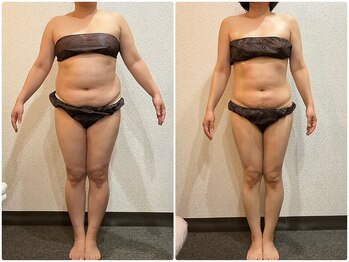 美容整体ウェリナ あま甚目寺院/小顔矯正/骨盤矯正/美脚サロン