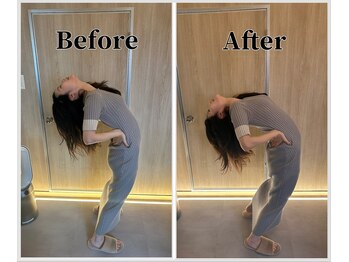 整体ラルース 中目黒(LALUZ)/20代 女性 腰痛、反り腰改善