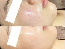 スリリアン 銀座/★お客さまビフォーアフター★