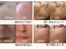 エー プラス リラボ(A plus Relab)