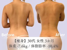 ベルペール(Belle perle)