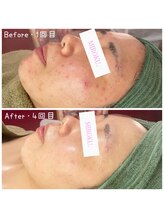 ミロク(MIROKU.)/BEFORE☆AFTER　ご覧ください