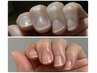 自爪育成再来の方
