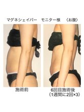 アルファイン 諏訪店/