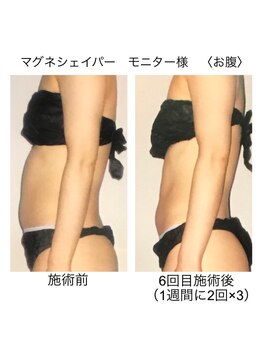 アルファイン 諏訪店/