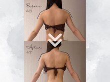 サイバーエステ 宇都宮店/3回でキレイな肩のライン