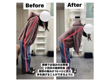 アンティオール 中目黒店/慢性的な腰痛改善整体