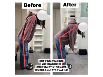 アンティオール 中目黒店/慢性的な腰痛改善整体