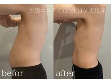 フラットベリー 恵比寿(Flat BELLY)の雰囲気（【施術例】腹囲マイナス7cm/全身スペシャル痩身150分コース10回）