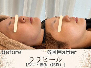 エスポワール(espoir)/before・after