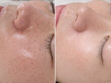 ルナ クレッシェンテ(Luna crescente)の雰囲気（毛穴悩みなら当サロンへ◎毛穴悩みの負のループを解消！[三田市]）