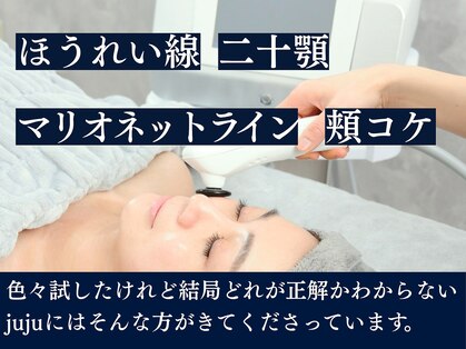 ジュジュ(juju)の写真