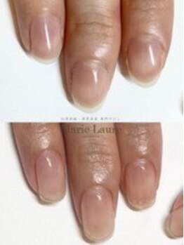 マリーロール 梅田店(Marie Laure)/自爪育成/深爪矯正/ネイルケア