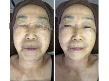 オリ(Oli)/最強フェイシャル3点セット　　