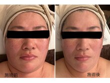 ル リアン(Le lien)/