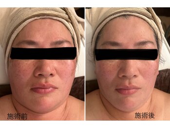 ル リアン(Le lien)/