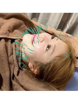 きらめき鍼灸治療院/お化粧をしたままで大丈夫です。