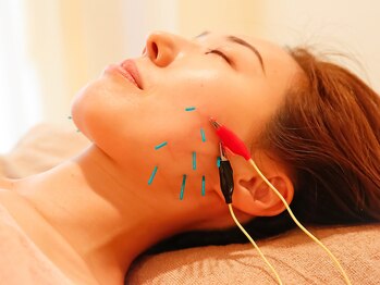 ハーリー 苦楽園(鍼利 HA-RI)/13/顔鍼もsetで