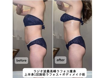 久遠(kuon)/即日効果!ラフォス痩身コース!