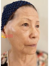 リアンシャンテ(Re enchanter)/☆お手入れ30回目(8ヶ月後)