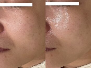 エミュ(emu)/毛穴レスな肌とはこれ!