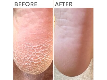 クオッカ(Quokka)の写真