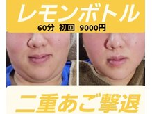 アン 銀座(ann)/二重あご撃退【レモンボトル】