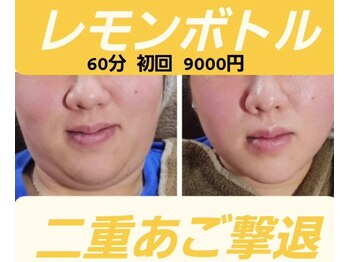 アン 銀座(ann)/二重あご撃退【レモンボトル】