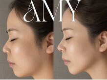 エイミー(Amy)/-【リフトアップマシーン】-