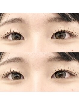バニーアイズ 天神(Bunny eyes TENJIN)/フラット120本